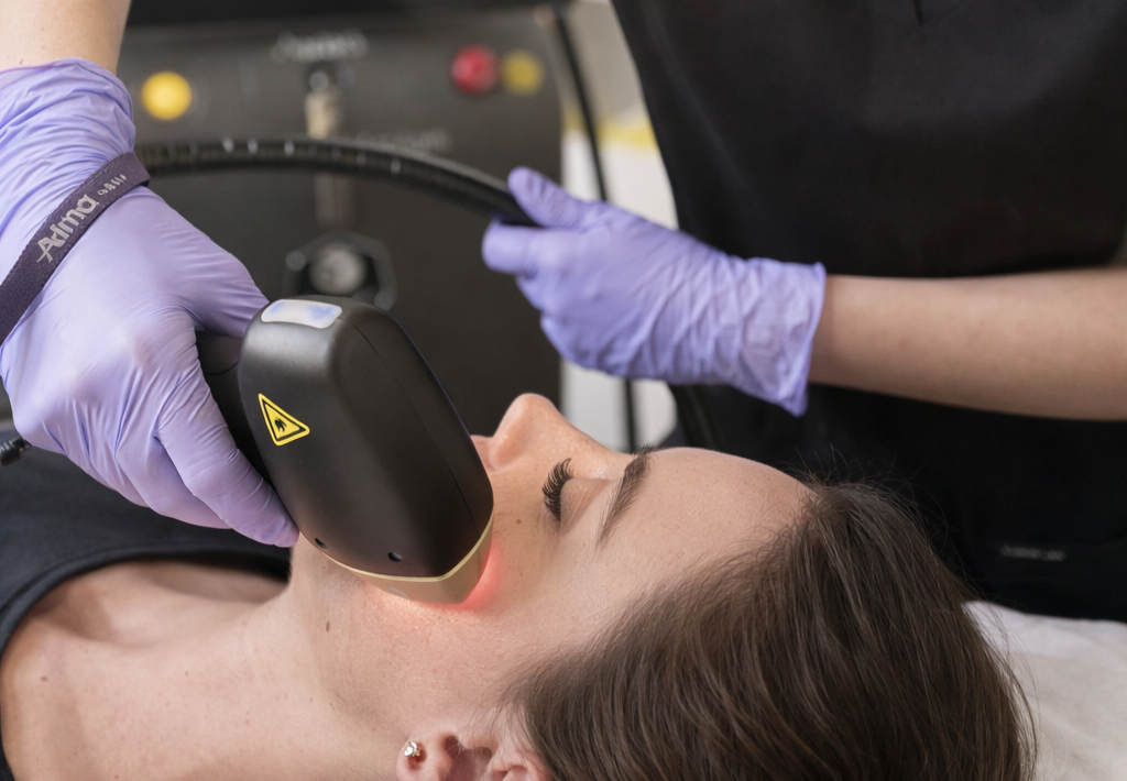 alma soprano titanium lifting